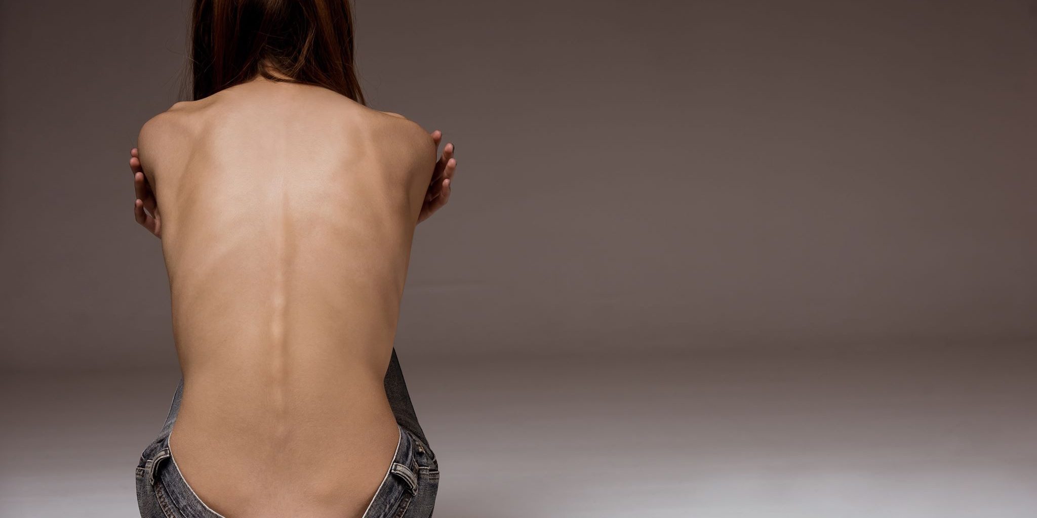 Източник: Shutterstock жена с хранително разстройство