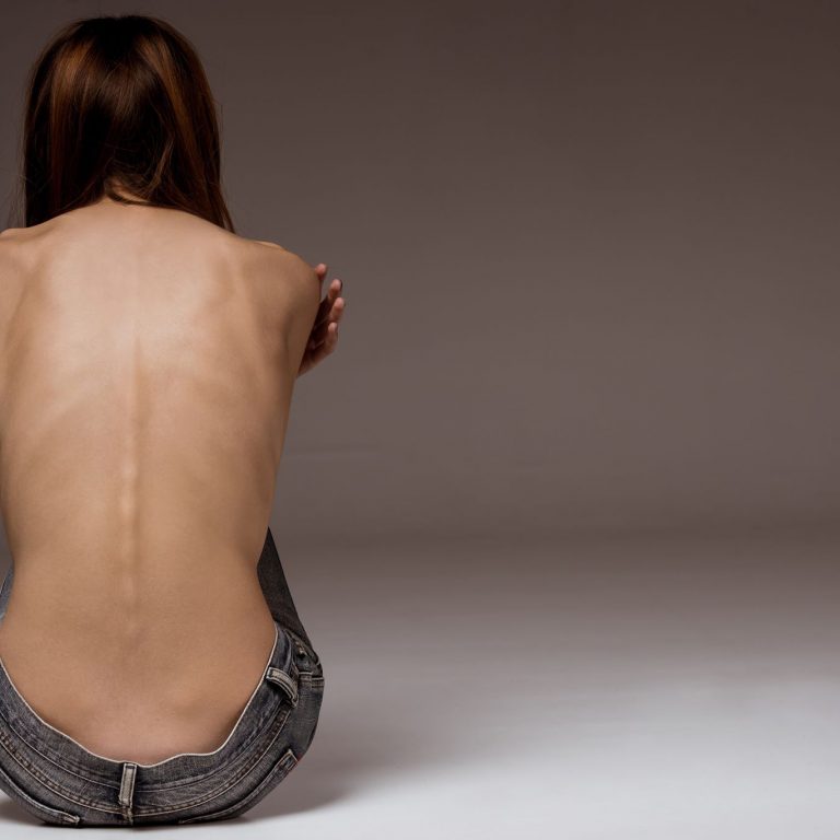 жена с хранително разстройство